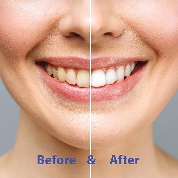 CHOMP Very Berry Toothpaste Tablets with NHAP Refills with Flossing Toothbrush